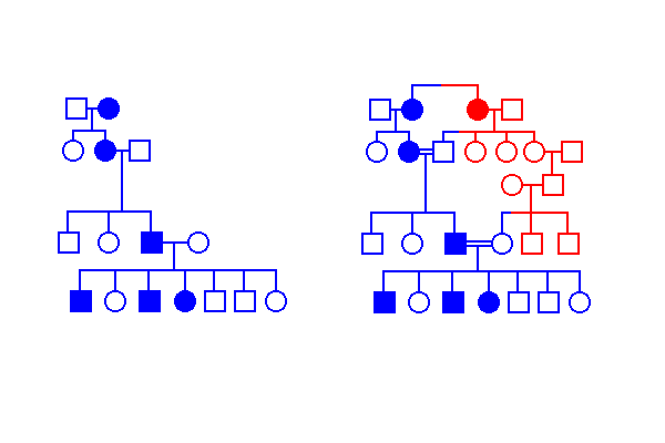 Alkaptonuria Pathway