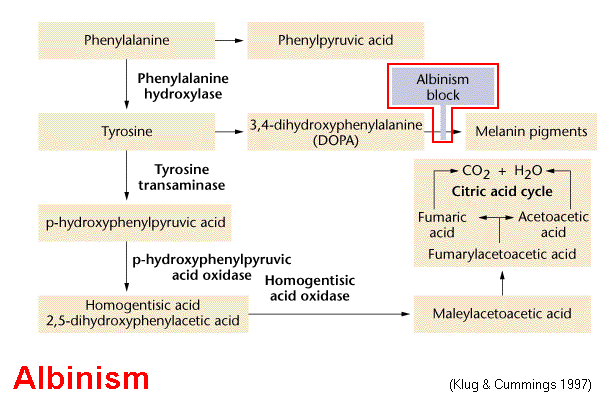 Albinism