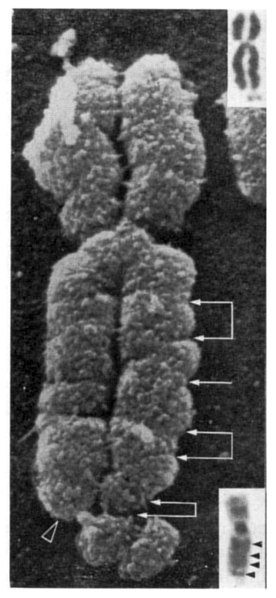 Fragile X chromosome