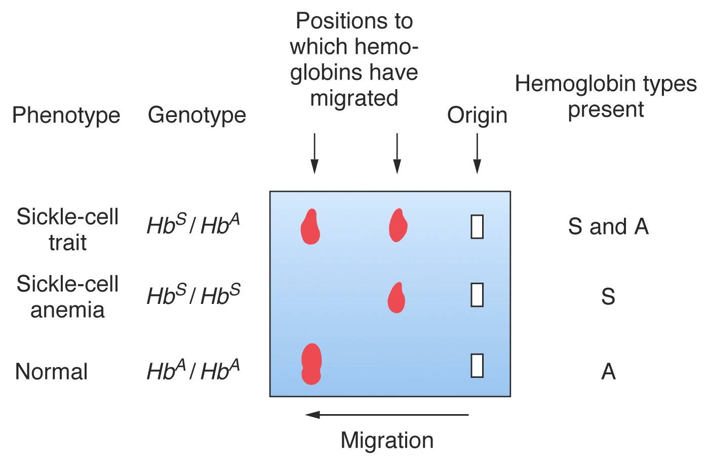 sickle cell electrophoresis