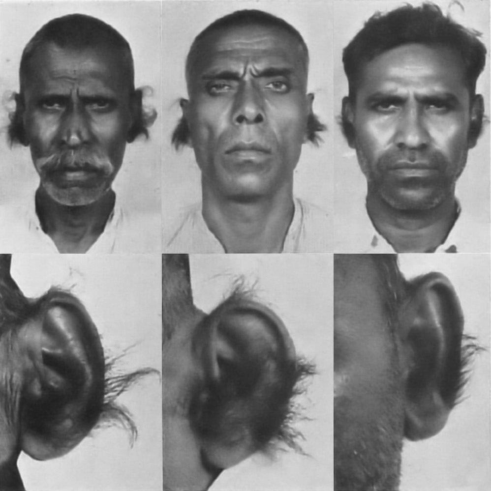 Hairy Ears in Indian Men