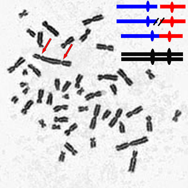 dicentric chromosome