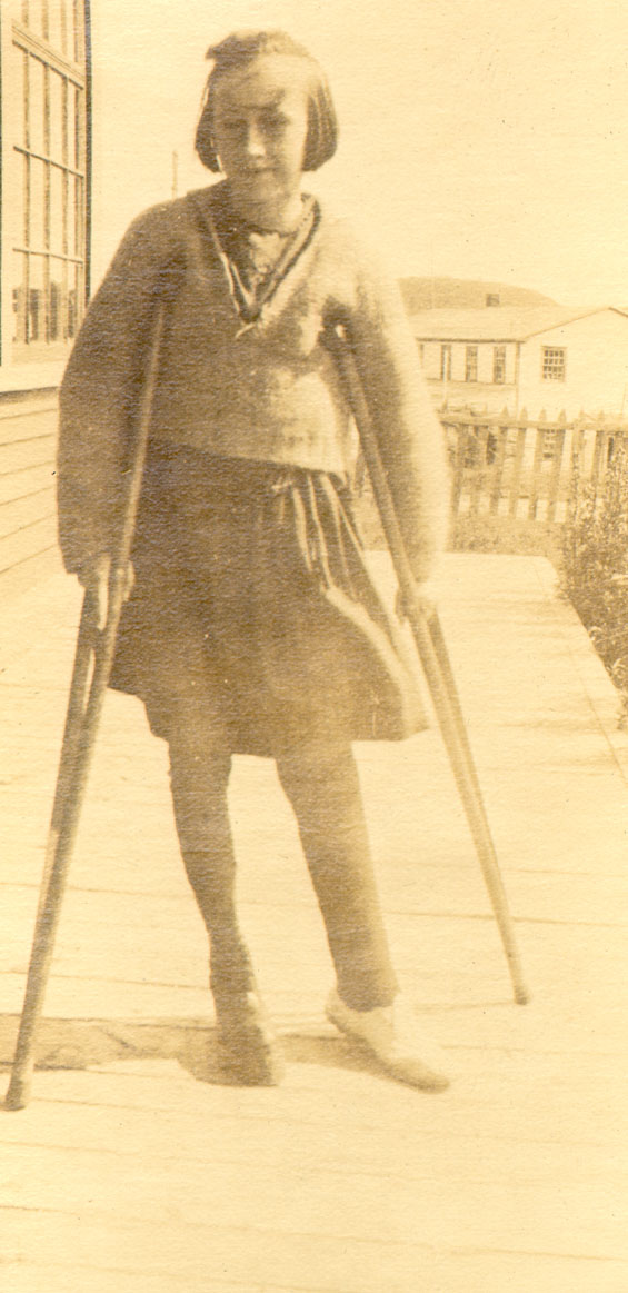 A young girl on crutches at the St. Anthony hospital