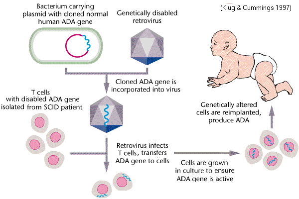 SCID Gene Therapy