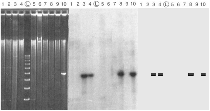 Southern Blot