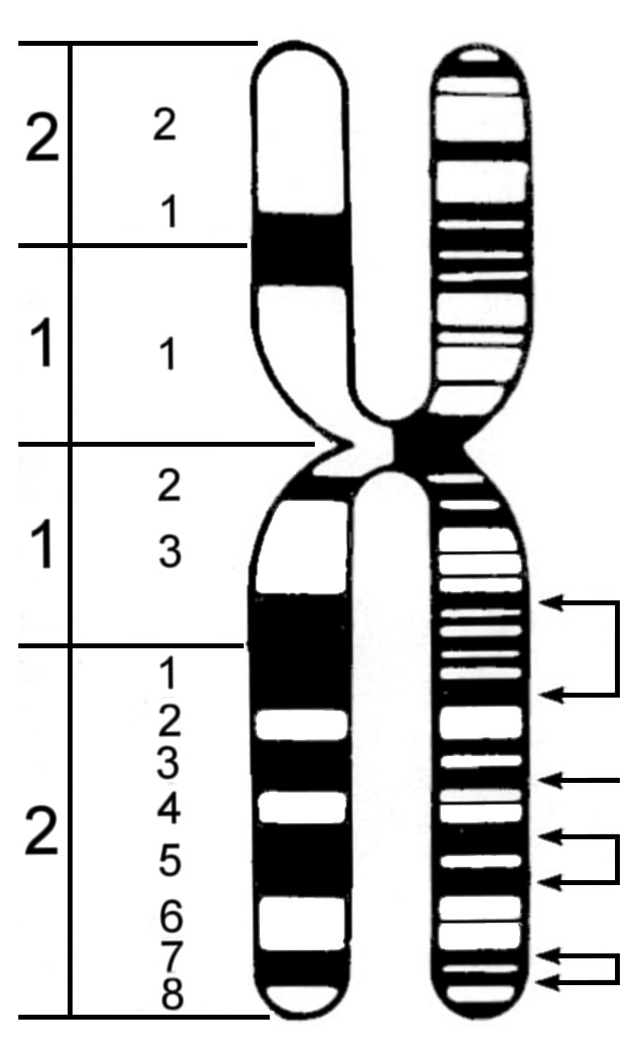 Fragile X chromosome
        idiogram