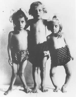 Children with
          phosphatemic rickets