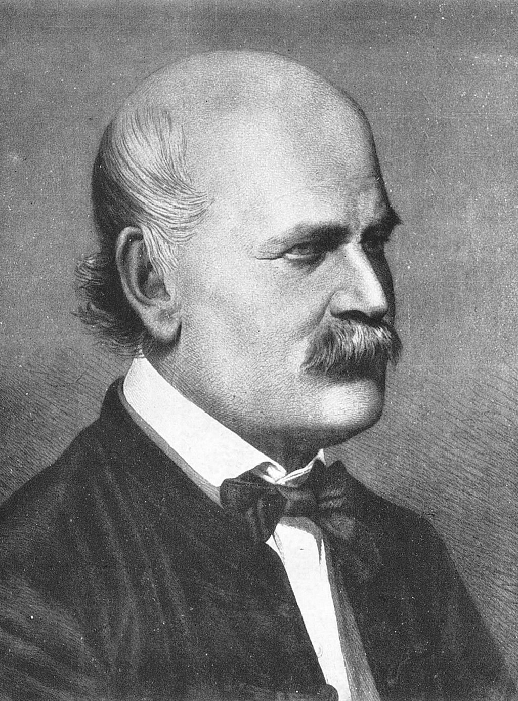 Ignatz
        Semmelweiss