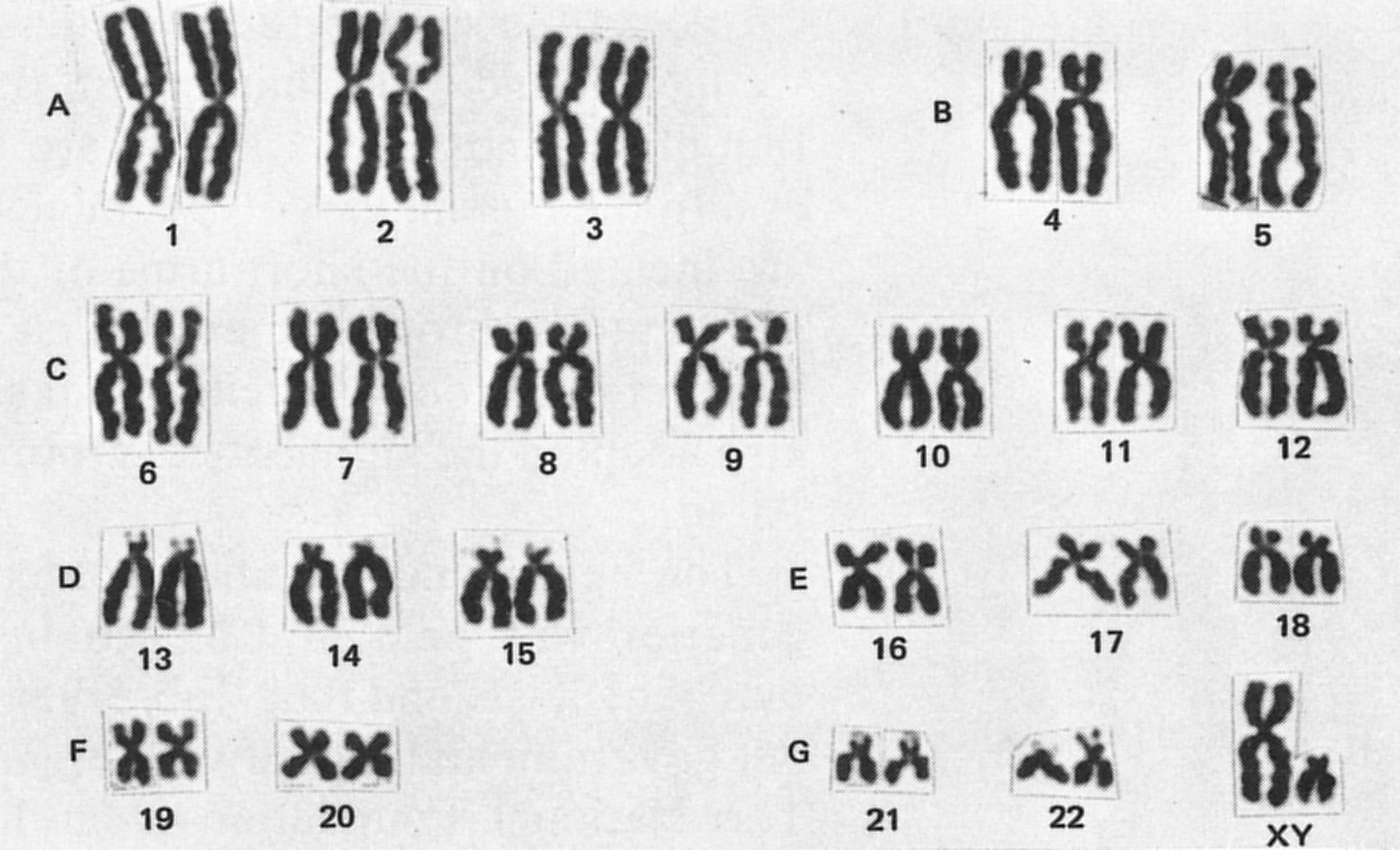 Giemsa Chromosome