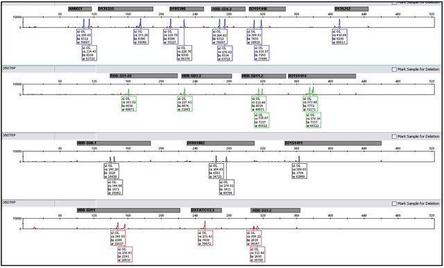 Multiplex
            capillary electrophoresis