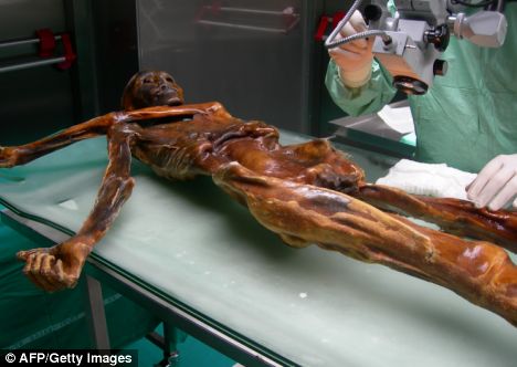 Oetzi
the Iceman