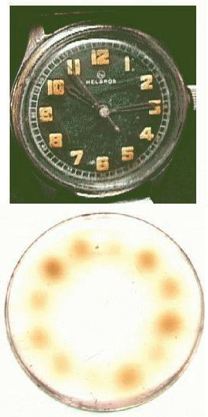 Radium Watch Dial Painters Radium Watch Dial Painters