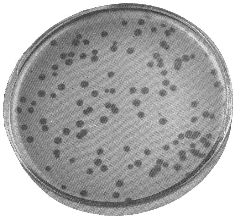 E. coli & T2 bacteriophage