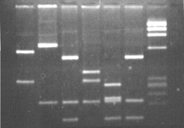 Gel electrophoresis