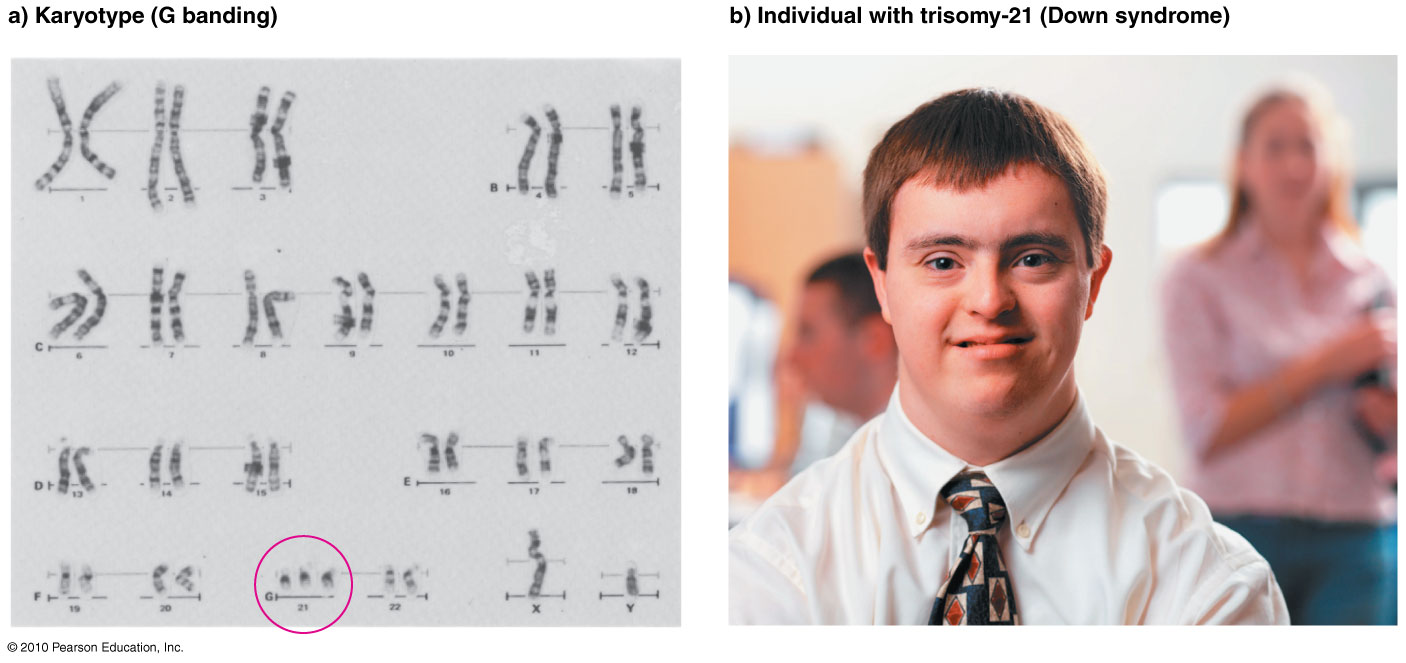 http://www.mun.ca/biology/scarr/iGen3_16_17_Figure-L.jpg