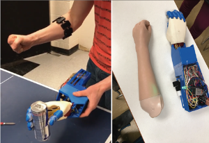 Myo Med Prosthetic Arm